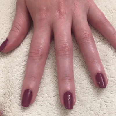 Understanding the Recent TPO Ban in Nail Products